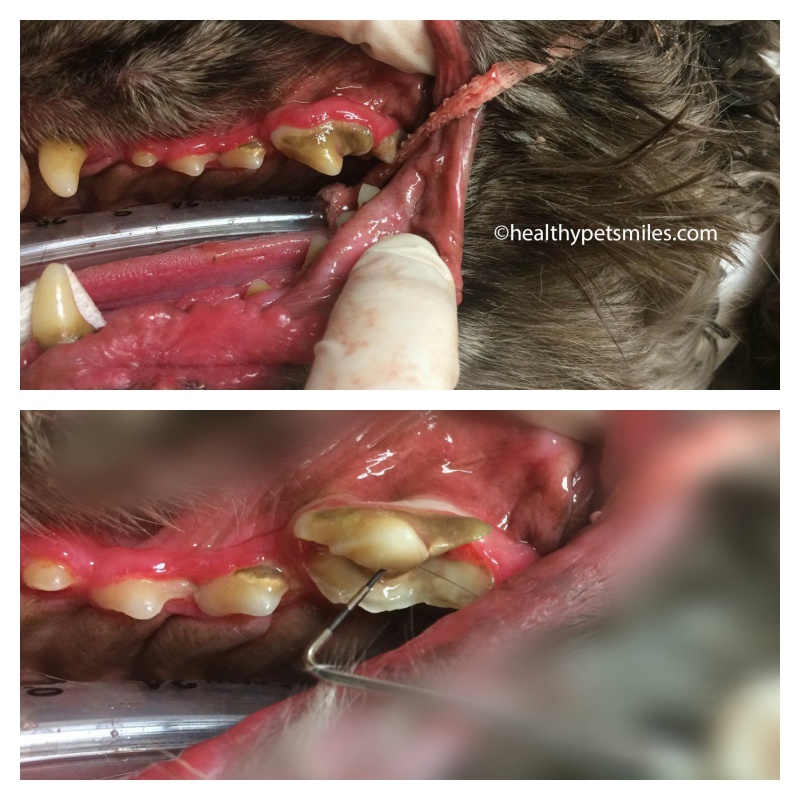 broken tooth - Fractured Teeth